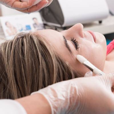 CHEMICAL PEELS